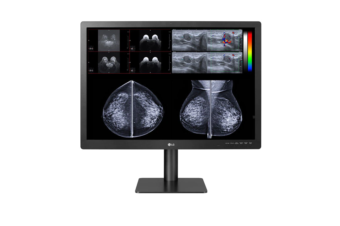 31 (78.74cm) 12MP Diagnostic Monitor for Mammography
